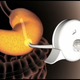 Image for article titled Terrifying New Bulimia Machine Will Suck Food From Your Stomach